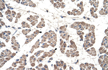 GCDH Rabbit Polyclonal Antibody
