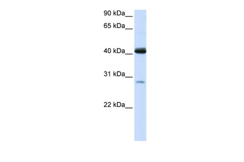 GCDH Rabbit Polyclonal Antibody