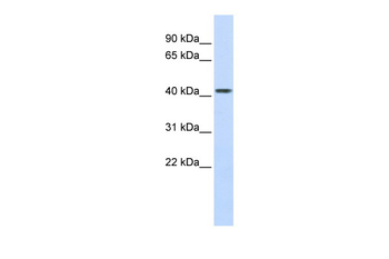 CPB2 Rabbit Polyclonal Antibody