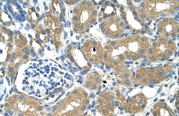 ADH4 Rabbit Polyclonal Antibody