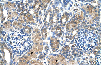 MTA2 Rabbit Polyclonal Antibody