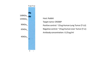 CREBBP Rabbit Polyclonal Antibody