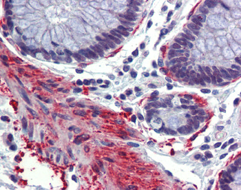 CREBBP Rabbit Polyclonal Antibody