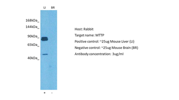 MTTP Rabbit Polyclonal Antibody