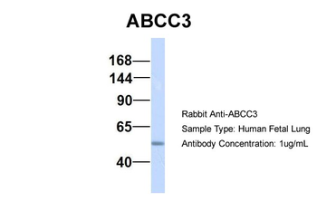 ABCC3 Rabbit Polyclonal Antibody