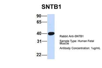 SNTB1 Rabbit Polyclonal Antibody