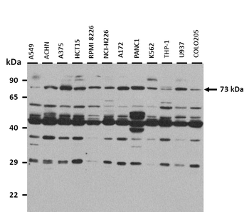 ABCG5 Rabbit Polyclonal Antibody