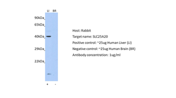 SLC25A20 Rabbit Polyclonal Antibody