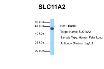 SLC11A2 Rabbit Polyclonal Antibody