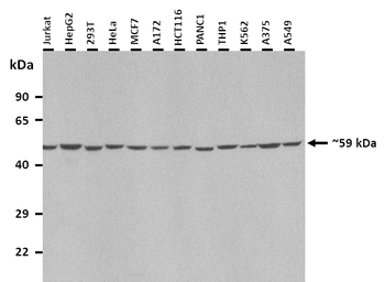 SLC2A9 Rabbit Polyclonal Antibody