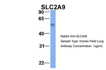 SLC2A9 Rabbit Polyclonal Antibody