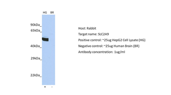 SLC2A9 Rabbit Polyclonal Antibody