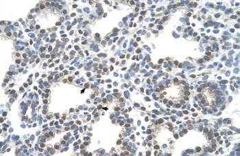 SLC10A5 Rabbit Polyclonal Antibody