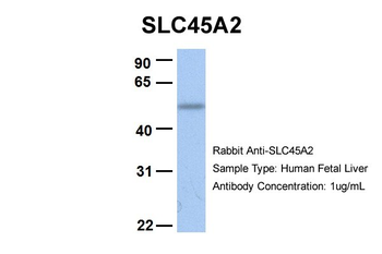 SLC45A2 Rabbit Polyclonal Antibody