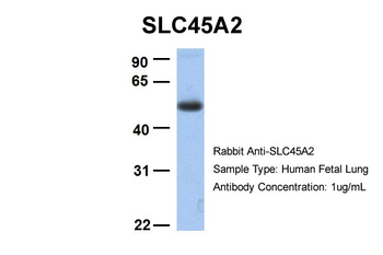 SLC45A2 Rabbit Polyclonal Antibody