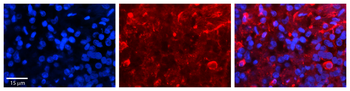 SLC27A6 Rabbit Polyclonal Antibody