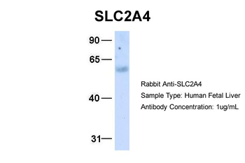 SLC2A4 Rabbit Polyclonal Antibody