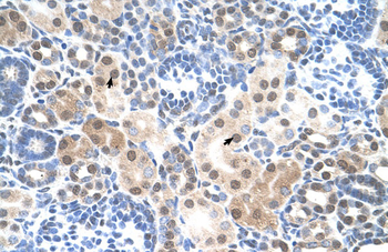 SLC25A45 Rabbit Polyclonal Antibody