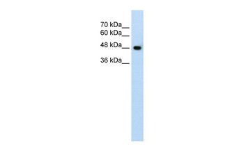 SLC38A1 Rabbit Polyclonal Antibody
