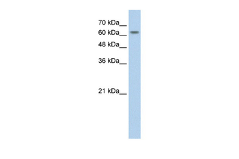 SLC38A1 Rabbit Polyclonal Antibody