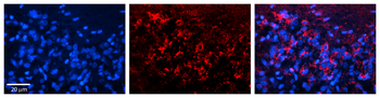 SLC25A4 Rabbit Polyclonal Antibody