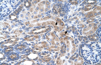 SLC29A2 Rabbit Polyclonal Antibody