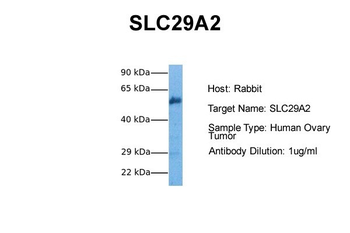 SLC29A2 Rabbit Polyclonal Antibody