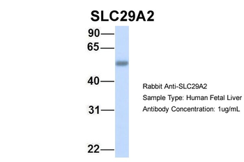 SLC29A2 Rabbit Polyclonal Antibody