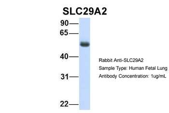 SLC29A2 Rabbit Polyclonal Antibody