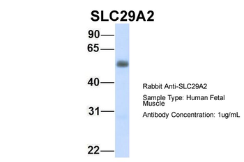 SLC29A2 Rabbit Polyclonal Antibody