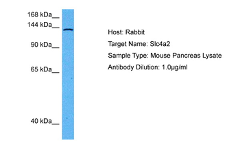 SLC4A2 Rabbit Polyclonal Antibody