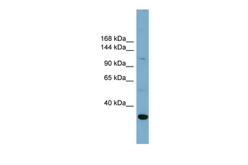 SLC9A1 Rabbit Polyclonal Antibody