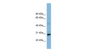 SLC16A1 Rabbit Polyclonal Antibody