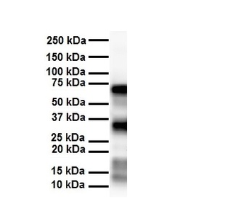 SLC25A12 Rabbit Polyclonal Antibody