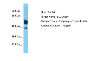 SLC9A3R1 Rabbit Polyclonal Antibody