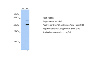 SLC16A7 Rabbit Polyclonal Antibody