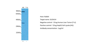 SLC6A14 Rabbit Polyclonal Antibody