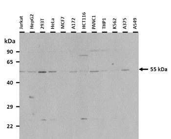 SLC17A5 Rabbit Polyclonal Antibody