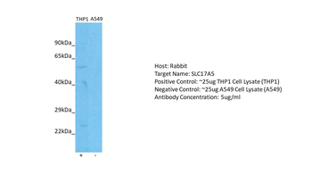 SLC17A5 Rabbit Polyclonal Antibody