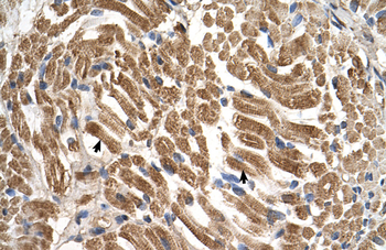 SLC17A5 Rabbit Polyclonal Antibody