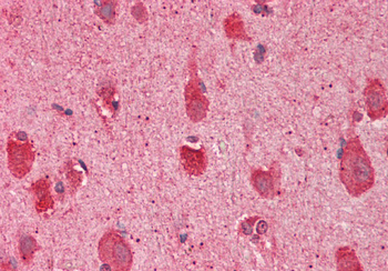SLC17A5 Rabbit Polyclonal Antibody