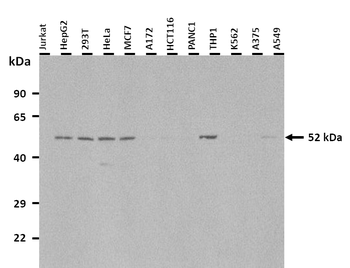 SLC16A8 Rabbit Polyclonal Antibody