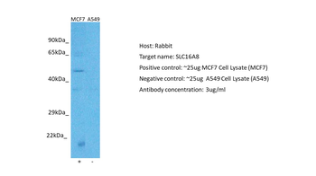 SLC16A8 Rabbit Polyclonal Antibody