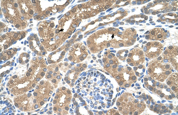 SLC16A8 Rabbit Polyclonal Antibody