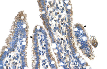 SLC25A39 Rabbit Polyclonal Antibody