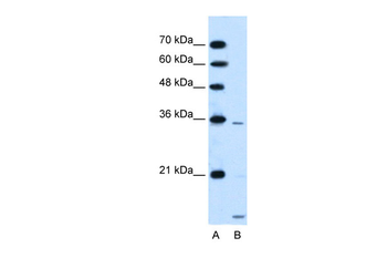 SLC25A39 Rabbit Polyclonal Antibody