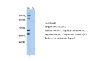 SLCO1C1 Rabbit Polyclonal Antibody