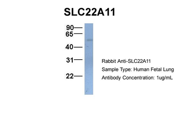 SLC22A11 Rabbit Polyclonal Antibody