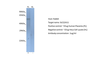 SLC22A11 Rabbit Polyclonal Antibody