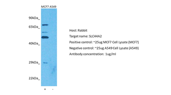 SLC44A2 Rabbit Polyclonal Antibody